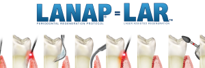 LANAP gum surgery by Dr Carl Werts